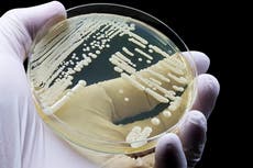 Estas son las 4 superbacterias más peligrosas de los EE. UU. este invierno