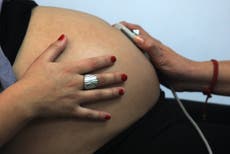 COVID: Médicos y enfermeras de maternidad enfrentan un agotamiento extremo por la escasez de personal 