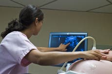 Anuncio de embarazo fracasa cuando pareja usa imagen de ultrasonido como regalo en intercambio navideño