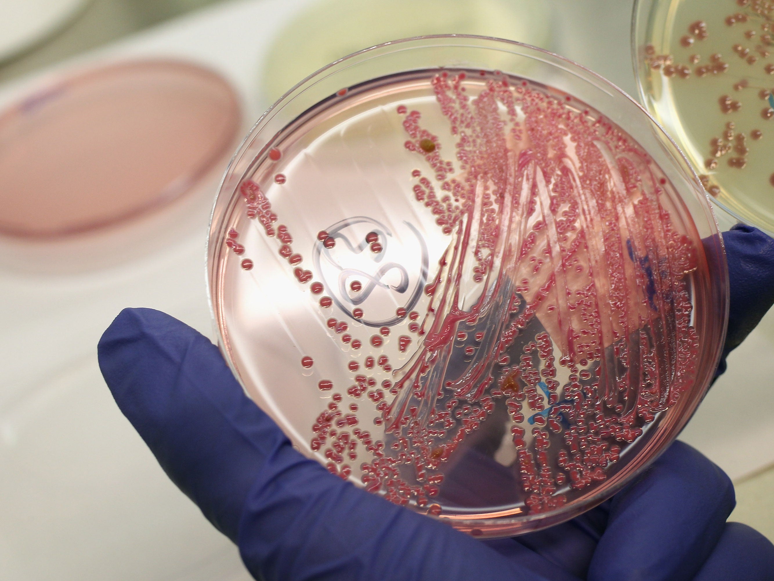 La nueva cepa de estreptococo del grupo A podría ser más propensa a causar infecciones internas graves