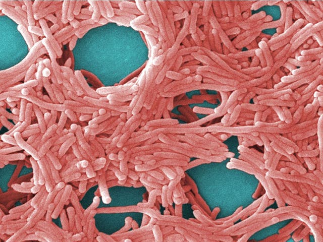 <p>La bacteria <em>Legionella</em> fue la responsable del brote</p>