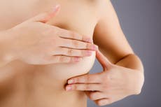 Síntomas del cáncer de mama: ¿Cuáles son los primeros signos de alerta?