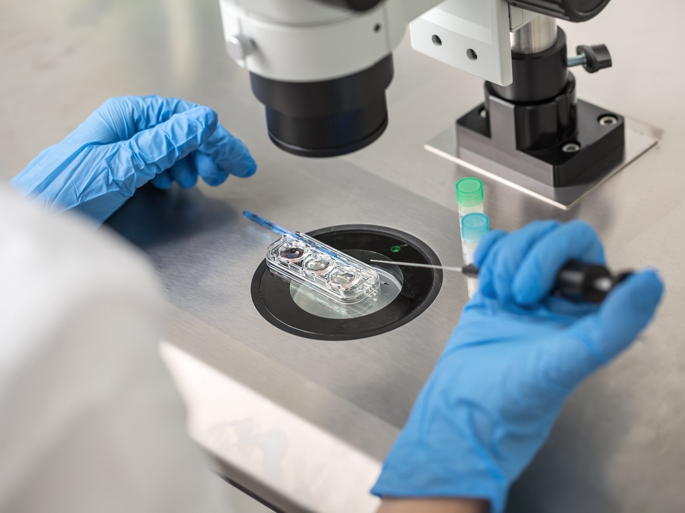 Los investigadores descubrieron que las microinyecciones de Shugoshin 1 parecían invertir el problema de la separación prematura de pares de cromosomas (imagen de archivo)